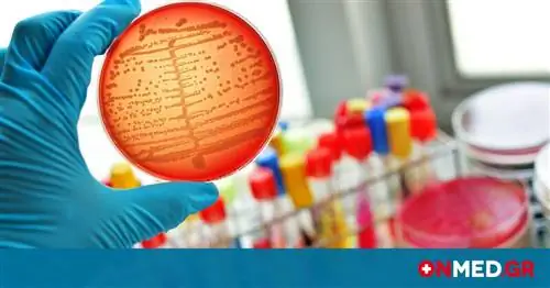 Сепсис: 11 опасных симптомов в картинках