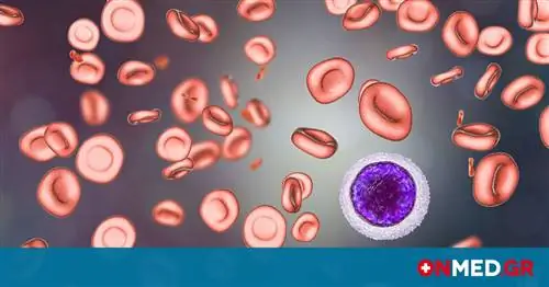 Дефицит железа: увеличьте потребление этого напитка (инструкция)