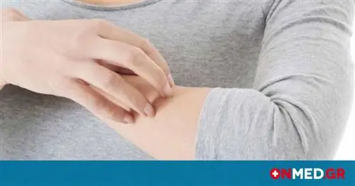 Атопический дерматит: положительные результаты лечения фазы 3