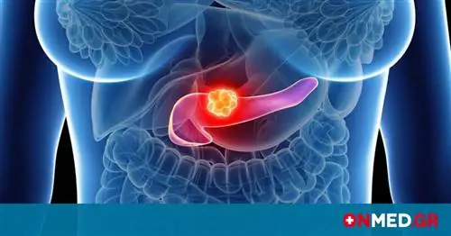 Рак поджелудочной железы: роль веса и возрастного риска