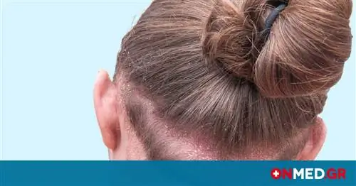Псориаз: превосходство секукинумаба подтверждается новым исследованием - Целью является чистая кожа