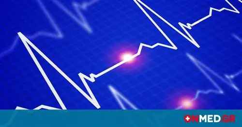 Лечение Амджен предотвращает сердечные приступы & сосудистых событий