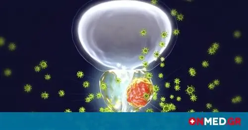 Рак простаты: лекарство из будущего