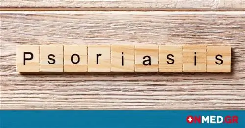 Псориаз ногтей, ладоней & подошв: Биологическое лечение дает долговременную эффективность