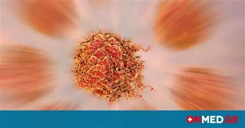 Надежды на остановку рака благодаря лекарствам от гриппа и простуды