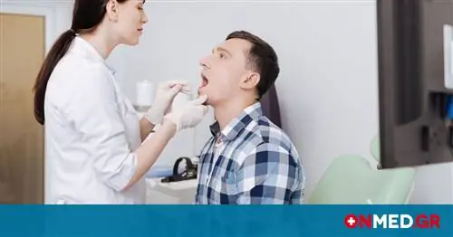 Рак полости рта: тест из 5 вопросов