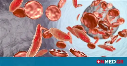 Гематологические наследственные заболевания (анемии): настоящее и будущее правильной диагностики