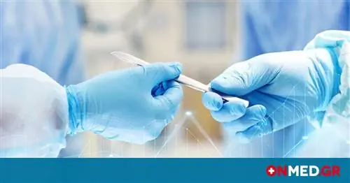 Пересадка сухожилия обеспечивает решение проблемы паралича седалищного нерва