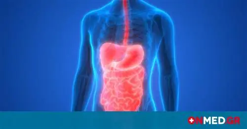 Гастроэзофагеальный рефлюкс: опасен, если его не лечить