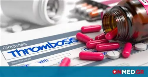 Тромбоэмболическая легочная гипертензия: положительные результаты в препарате Актелион