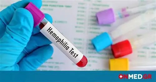 Гемофилия: Пожертвование 4 миллионов единиц лекарств компанией CSL Behring