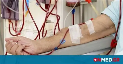 Незастрахованные: включение пациентов с гемоочисткой в постоянную программу – решение Xanthos