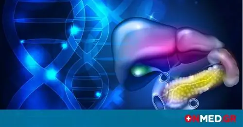 Проблемы с желчью? Все, что нам нужно знать, чтобы избежать боли