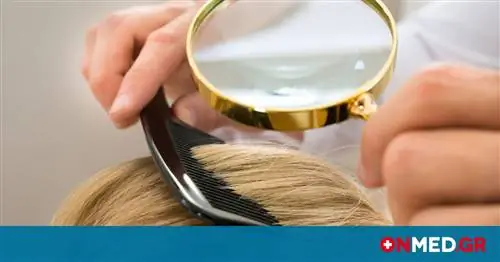 Псориаз на голове: Причины и лечение
