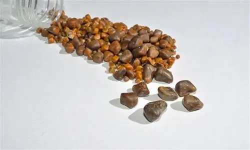 Камни в желчном пузыре: как они влияют на сердце