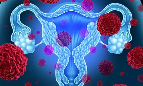 Рак шейки матки: какие анализы включает скрининг