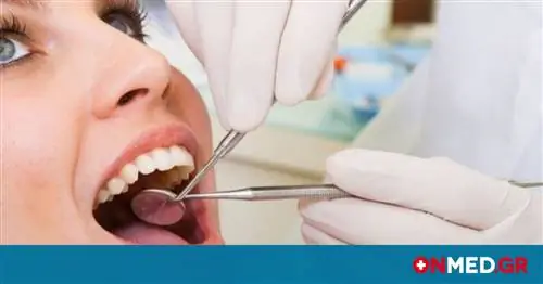 Рак поджелудочной железы: 2 признака, которые может обнаружить стоматолог