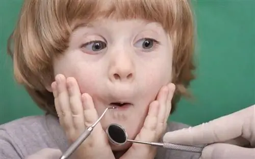 Посмотрите, что сахар делает с детскими зубами - Шокирующие изображения