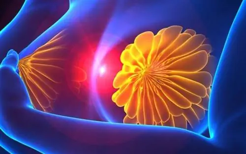 Самообследование молочных желез: как интерпретировать результаты