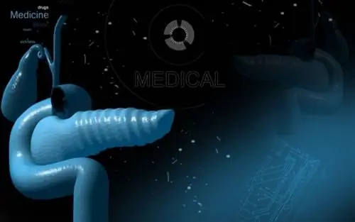 Рак поджелудочной железы: основные ответы на вопросы о причинах, симптомах, лечении