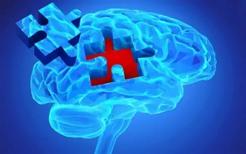 Пробелы в памяти: повседневное, неизбежное и… тревожное