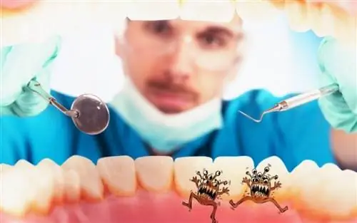 Зубы: когда они «показывают» инсульт и болезни сердца