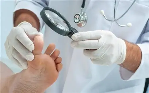 Грибковые инфекции кожи: что их вызывает и как себя защитить