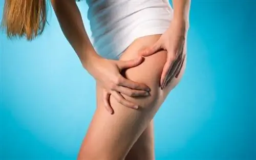 Что нам всем нужно знать о целлюлите