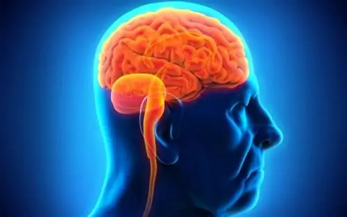 Инсульт: настораживающие признаки и факторы риска