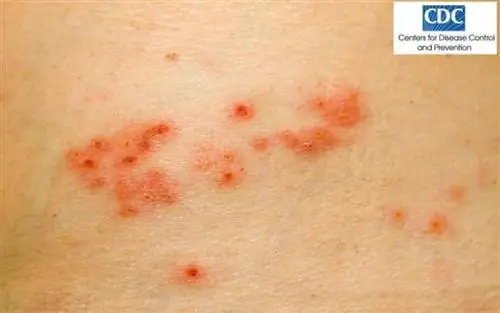 Черепица: все, что вы хотите спросить