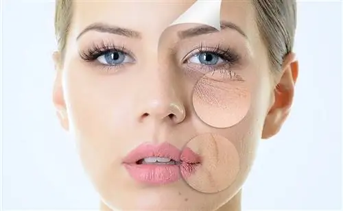 Посмотрите, что вы можете получить, если вам не хватает коллагена