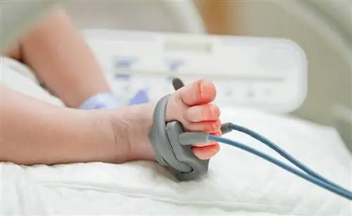 The Lancet: Мертворождение - трагический результат жесткой экономии