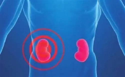 Что вы знаете о своих почках? Всемирный день почек