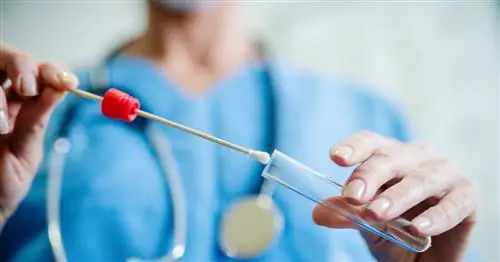 Микоз пищевода - симптомы, диагностика, лечение. Какие могут быть причины?