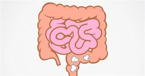 Изопороз - причины, симптомы, диагностика. Как лечить изоспороз?