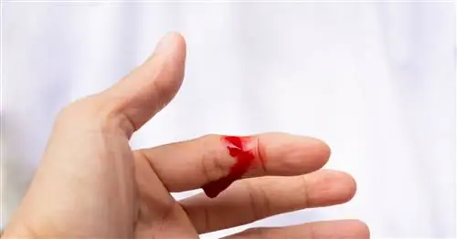 Кровотечение - виды и первая помощь