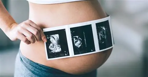 Пренатальный дуэт