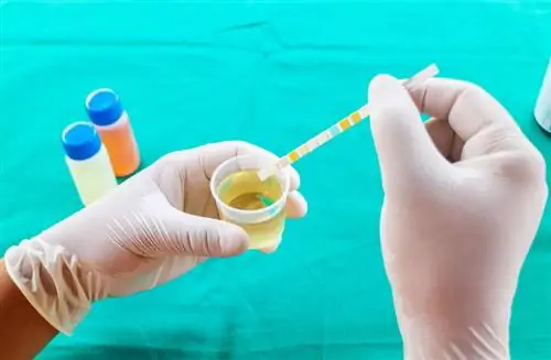 Анализ мочи