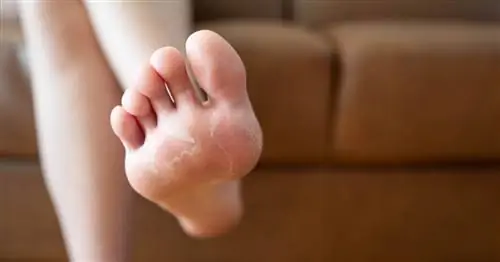 Клотримазол HASCO - состав, действие, показания, применение крема от микоза, заменители