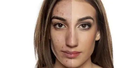 Дуак - состав, действие, применение, противопоказания, побочные эффекты