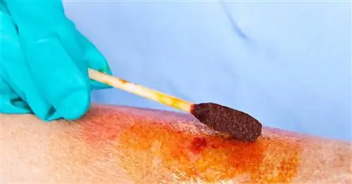 Йод - состав, действие, показания, применение, противопоказания