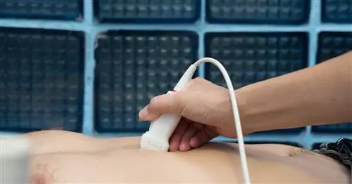 Рак поджелудочной железы крайне злокачественен. «На момент постановки диагноза 80 процентов пациентов подходят только для паллиативного лечения»