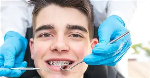 Кто-нибудь может носить брекеты?