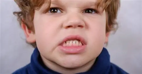 Progenia - причины и особенности неправильного прикуса. Как лечится прогения?