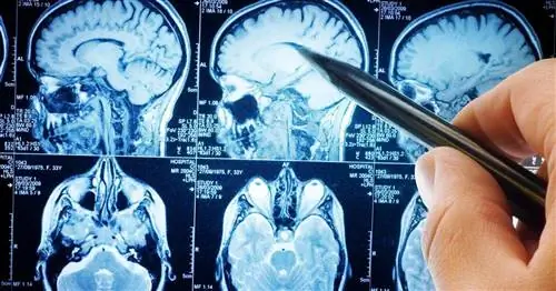 Может ли маммография вызывать рак? Разговор с проф. Ежи Валецкий, радиолог