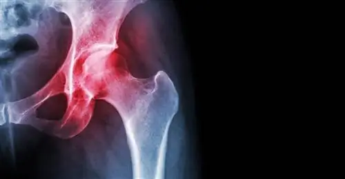 Тазобедренный сустав - первые болевые ощущения - повод для беспокойства?