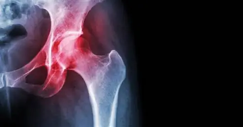 Тазобедренный сустав на всю жизнь