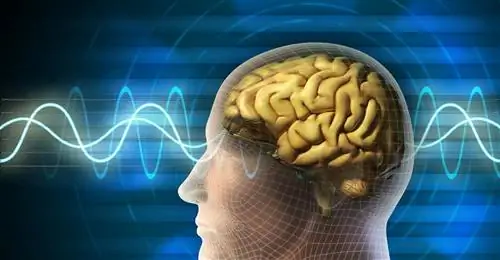 ЭКГ, запись мозговых волн