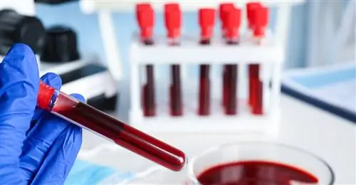 жалюзи 1664031304