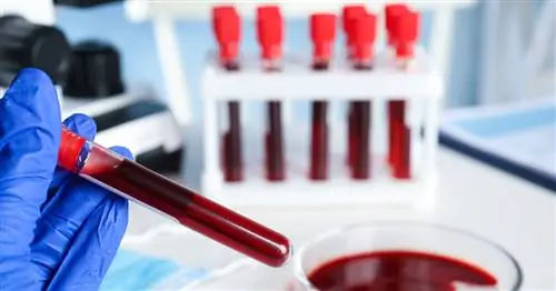 О чем свидетельствуют редуцированные моноциты в морфологии?